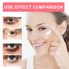 Anti Wrinkle Eye Cream